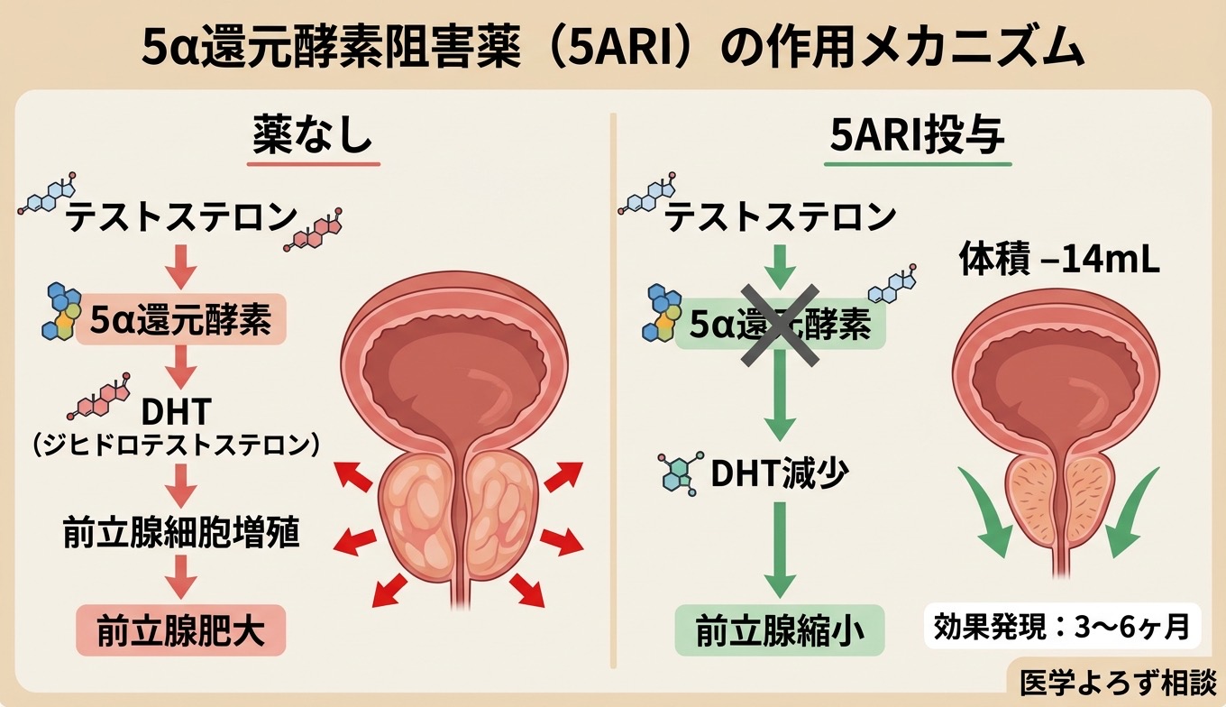 5α還元酵素阻害薬（5ARI）の作用メカニズム