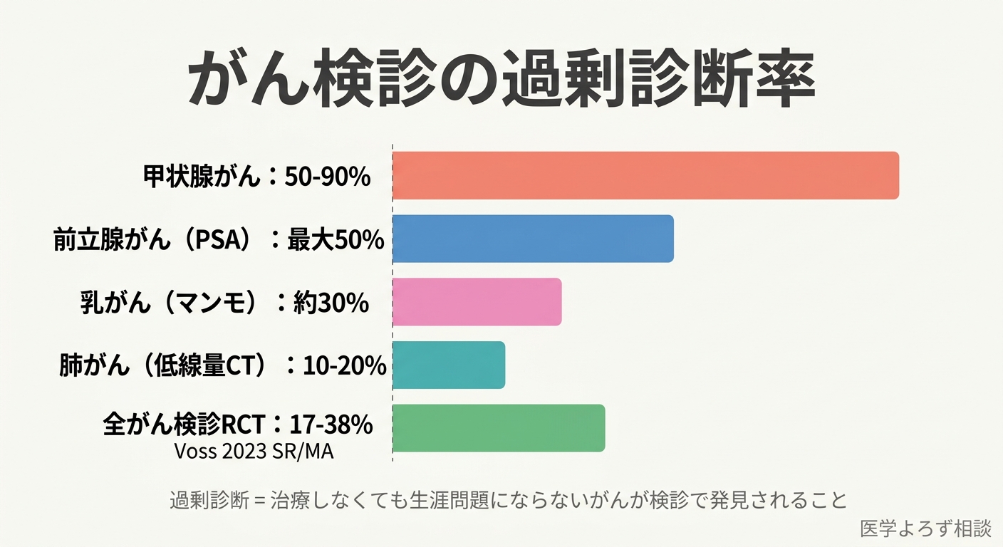 がん種別の過剰診断率の比較棒グラフ：甲状腺がん50-90%、前立腺がん最大50%、乳がん約30%、肺がん10-20%