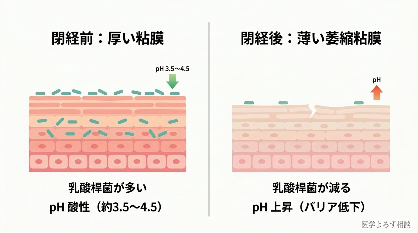 閉経前の厚い腟粘膜（乳酸桿菌が多くpHが酸性）と閉経後の薄い萎縮粘膜（乳酸桿菌が減りpHが上昇）を左右で対比した図