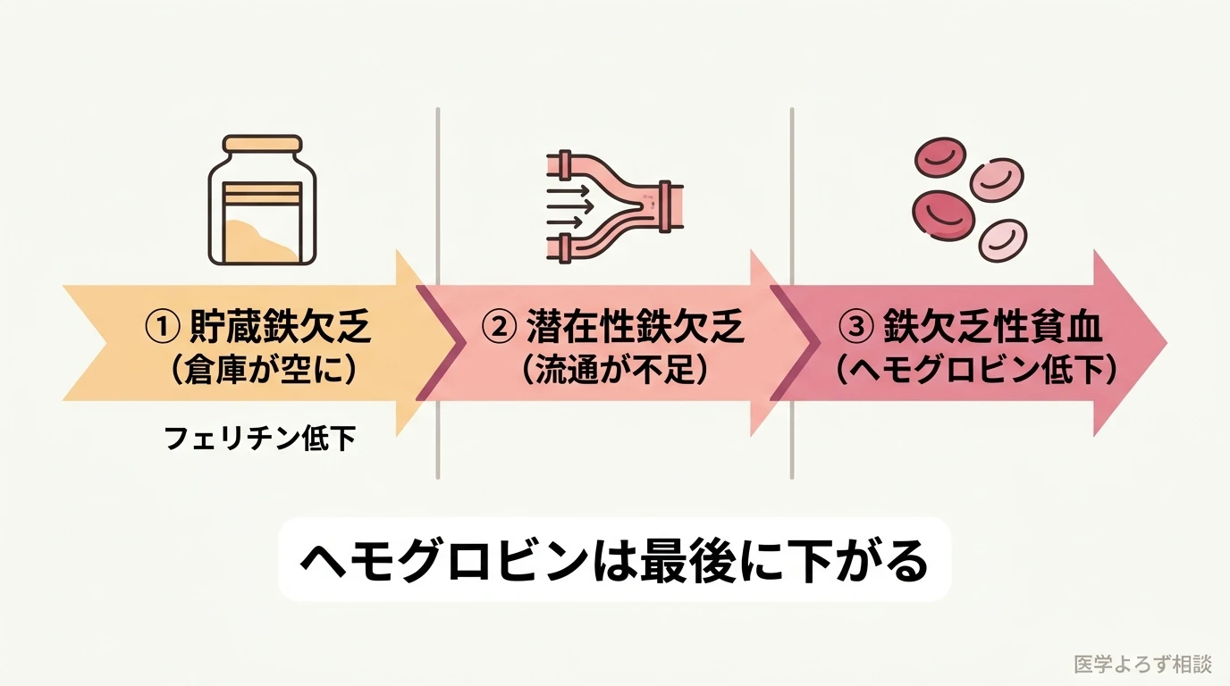 鉄欠乏が貯蔵鉄欠乏・潜在性鉄欠乏・鉄欠乏性貧血の3段階で進み、ヘモグロビンが下がるのは最後であることを示すタイムライン図