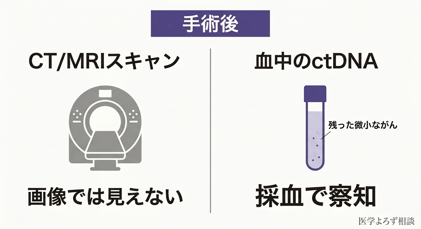 術後、CTには映らない微小な残存がん細胞が血液中にctDNAを漏らしている様子と、それを採血で検出するMRDの概念図