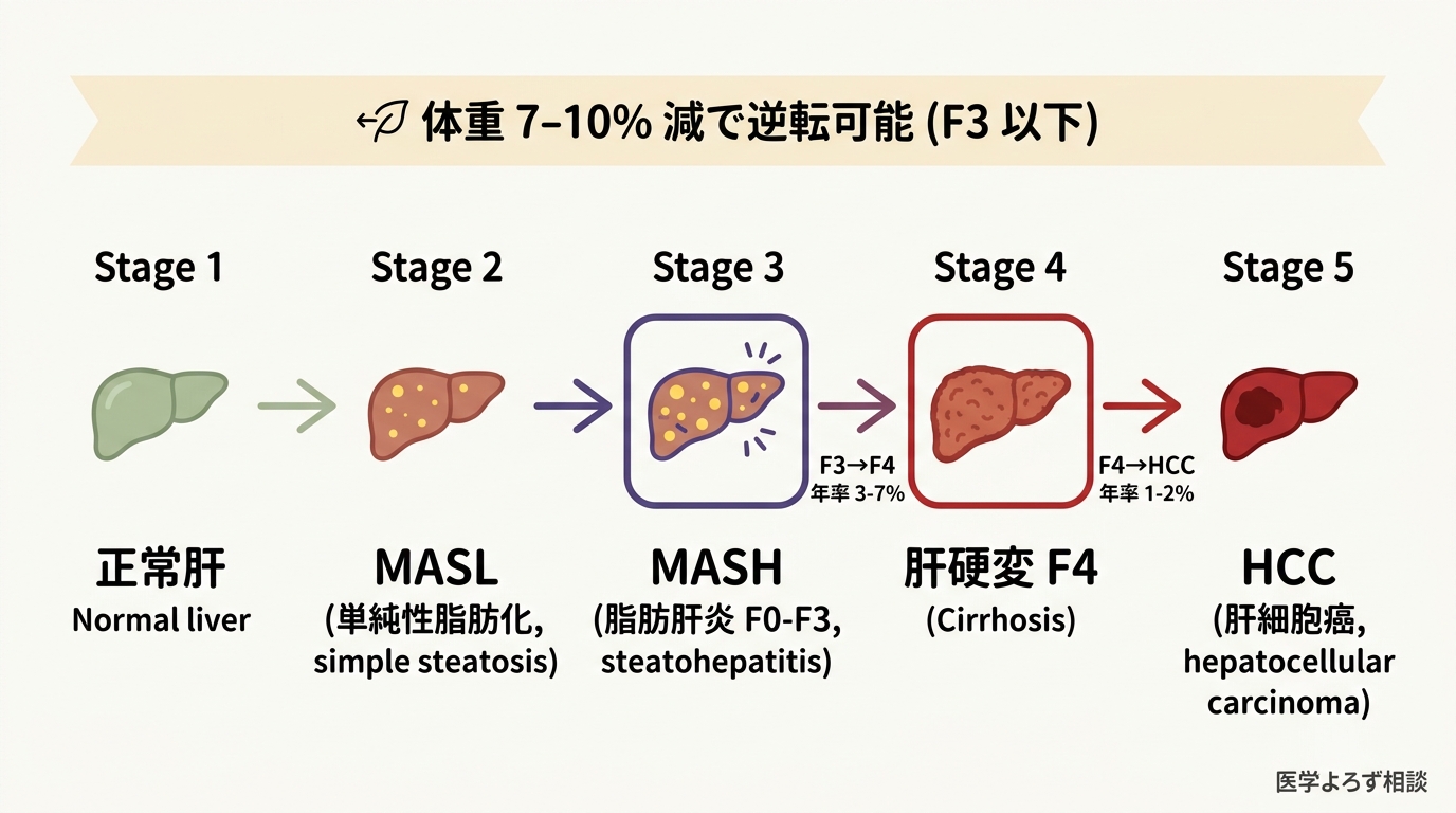 MASLD 進行フロー図。左から右へ：正常肝 → MASL（単純性脂肪化、5% 以上の肝細胞脂肪化）→ MASH（脂肪肝炎、F0-F3 線維化）→ 肝硬変 F4 → HCC（肝細胞がん）。各ステップ間に年率注記：F3→F4 年率 3-7%、F4→HCC 年率 1-2%。上部に「F3 以下なら体重 7-10% 減で逆転可能」の保護的メッセージ。出典: AASLD Practice Guidance 2023, EASL 2024。