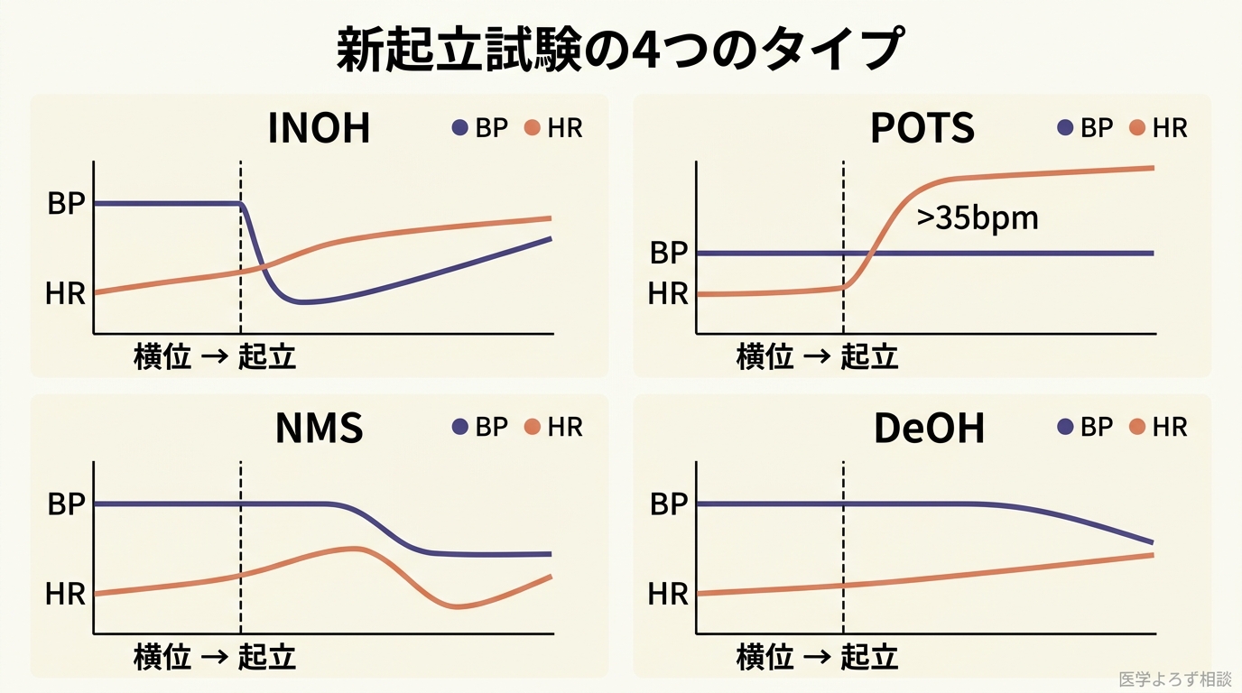 新起立試験における 4 サブタイプの血圧・心拍パターン比較図。【INOH】起立直後性低血圧 (Instantaneous Orthostatic Hypotension): 起立直後に血圧が大きく低下し回復遅延、心拍は軽度上昇、主訴は立ちくらみ・めまい。【POTS】体位性頻脈症候群 (Postural Orthostatic Tachycardia Syndrome): 血圧は維持されるが心拍が ΔHR ≥35bpm または起立時 HR ≥115bpm 上昇 (日本 GL2015)、海外では成人 +30bpm・思春期 +40bpm 基準、主訴は動悸・倦怠感・集中力低下。【NMS】神経調節性失神 (Neurally Mediated Syncope): 起立中期〜後期に血圧低下、続いて反射性に心拍低下 (混合型・血管抑制型・心抑制型)、主訴は失神。【DeOH】遷延性起立性低血圧 (Delayed Orthostatic Hypotension): 3〜10 分後に血圧が遅発性低下、心拍は代償的に上昇、主訴は立位持続中の気分不良。