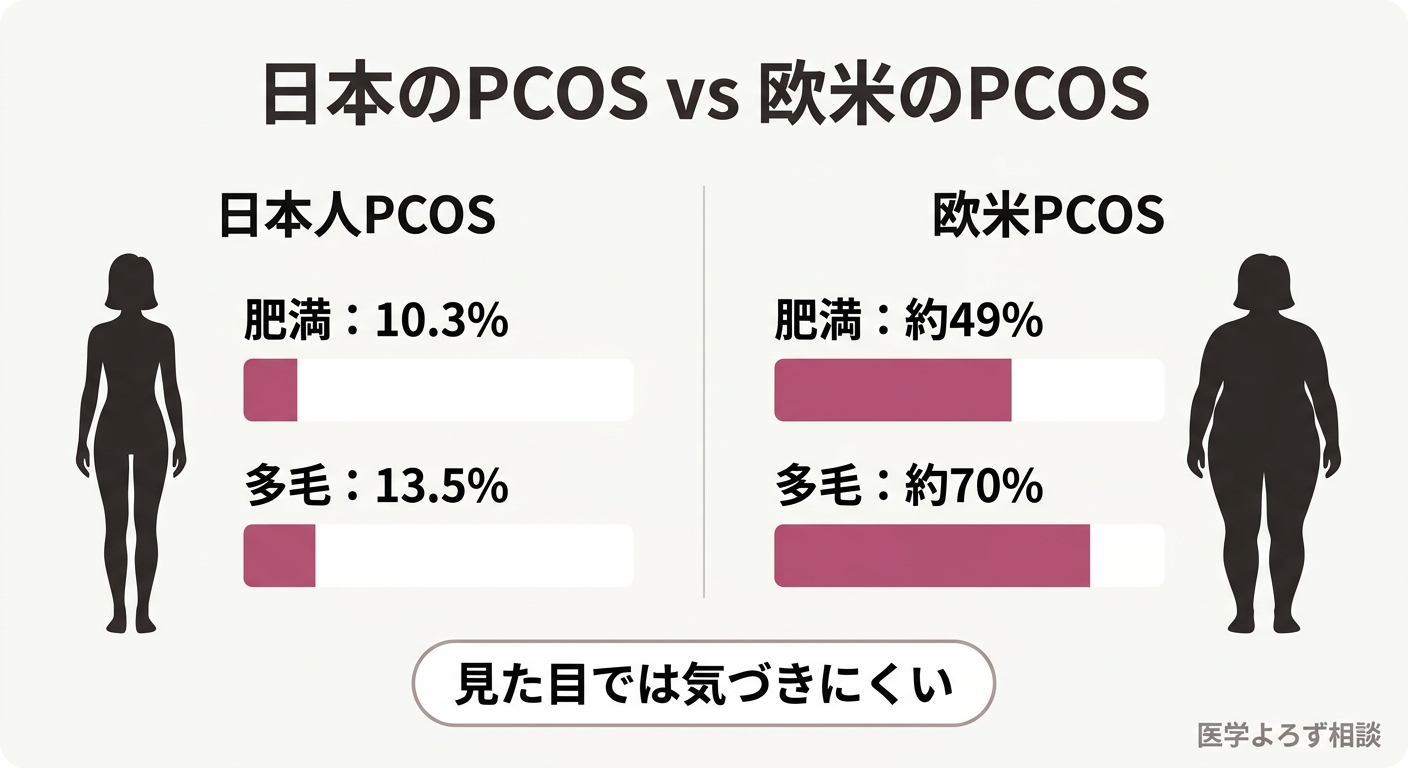 日本のPCOSと欧米のPCOSの特徴比較。日本はやせ型・非多毛が多く、見た目で気づきにくい