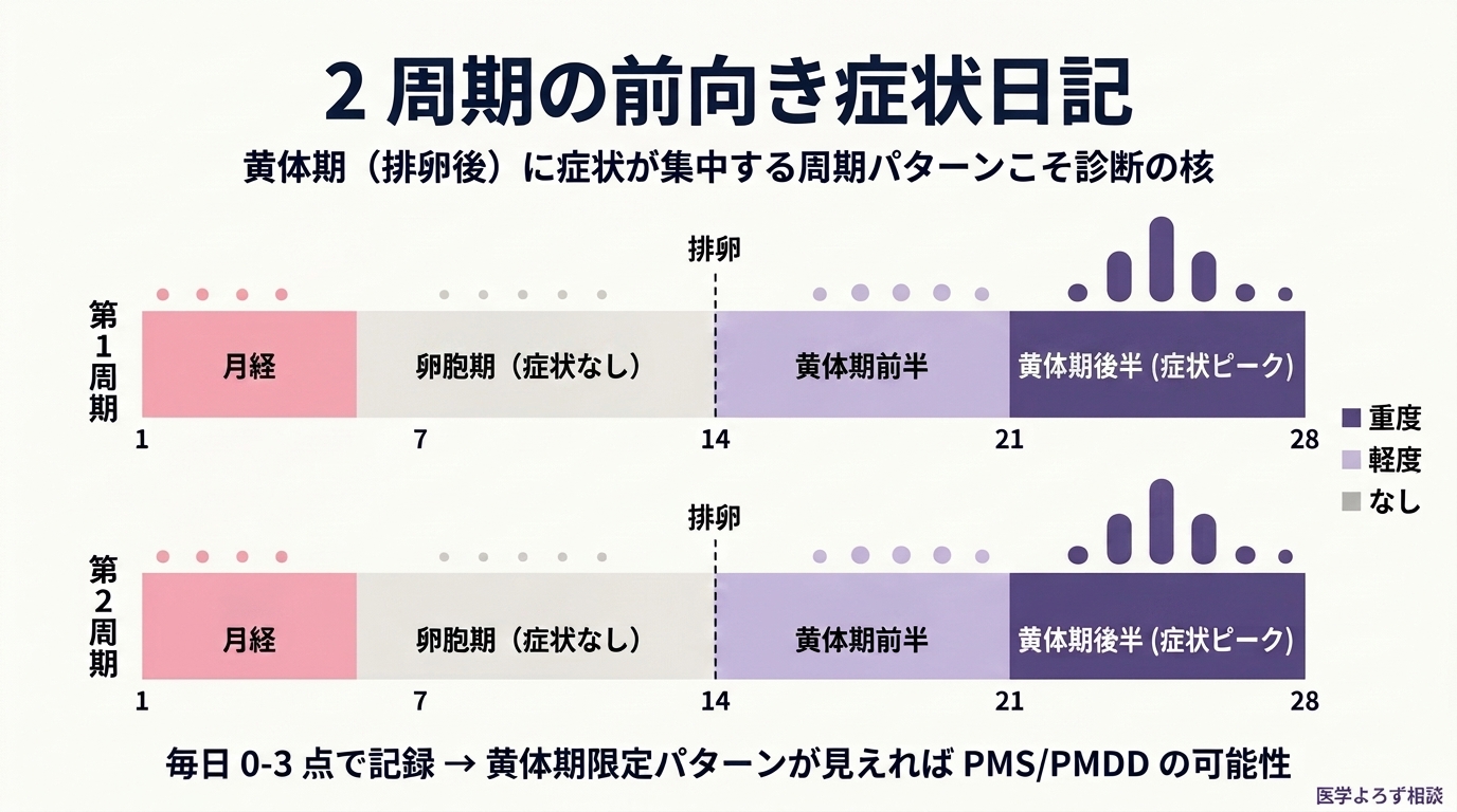 2 周期の前向き症状日記の概念図。月経・卵胞期（症状なし）・排卵・黄体期前半・黄体期後半（症状ピーク）の周期パターンを 2 サイクル並べて表示し、黄体期に症状が集中する反復パターンを可視化