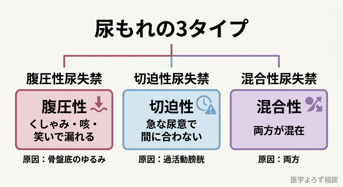 尿もれ3タイプの見分け方フロー。腹圧性（くしゃみ・咳で漏れる）、切迫性（急な尿意で間に合わない）、混合性（両方）の特徴を、きっかけと症状で振り分ける分類図