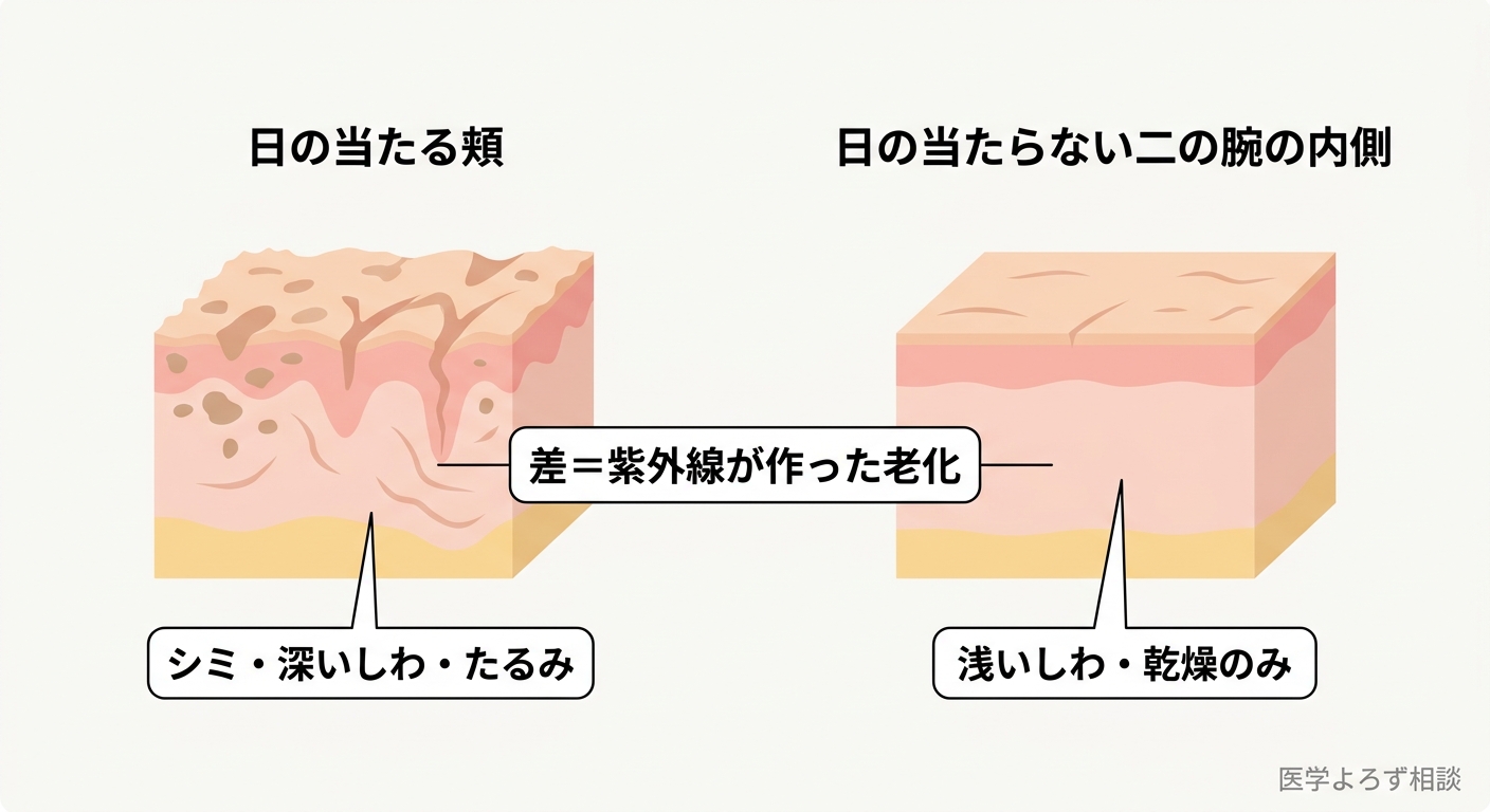 同じ年齢でも、日の当たる頬と日の当たらない二の腕内側で皮膚の老化の見た目が大きく異なることを示す比較概念図